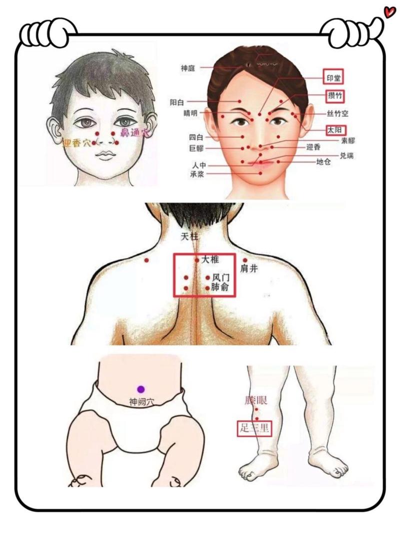 艾灸穴位图解 鼻炎