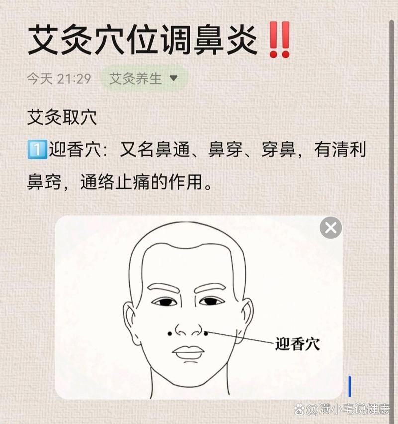 艾灸穴位图解 鼻炎