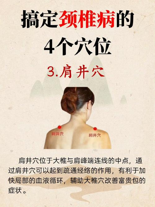 颈椎增生 骨刺艾灸穴位