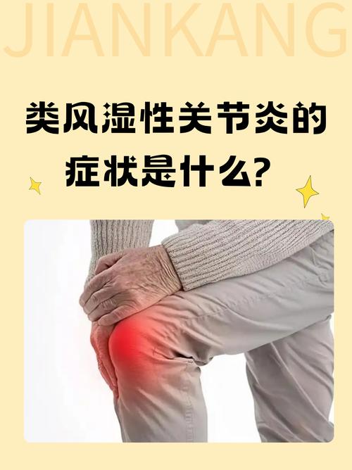 类风湿性关节炎类风湿性关节炎