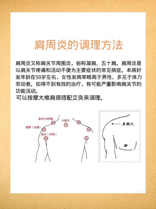 治疗肩周炎针灸哪些穴位