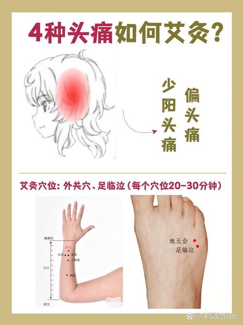 头痛 浑身发冷艾灸穴位