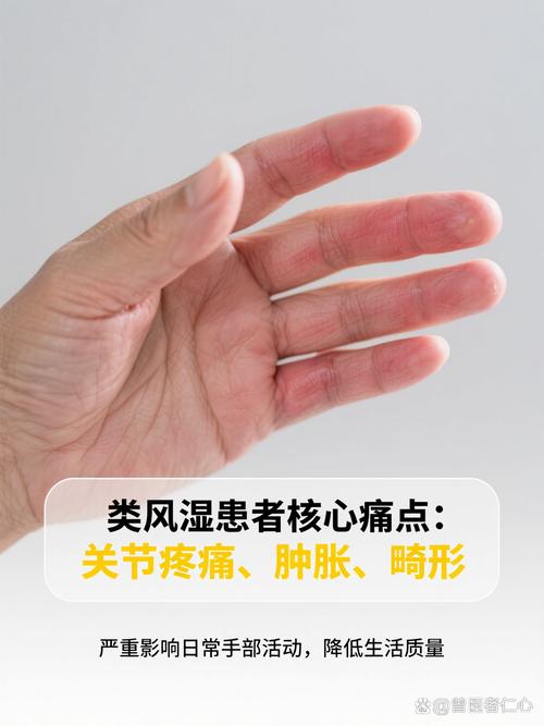 全国最好的类风湿医院排名第一