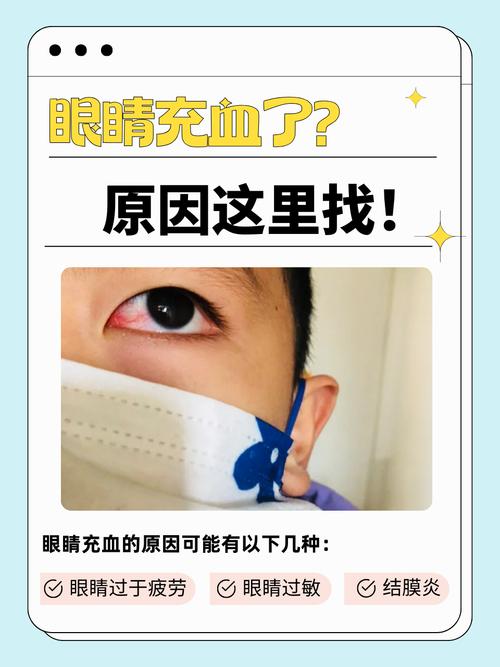 脑梗患者眼睛充血是怎么回事