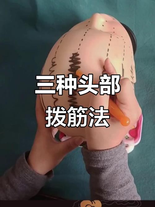 脑梗恢复最好的方法头部按摩