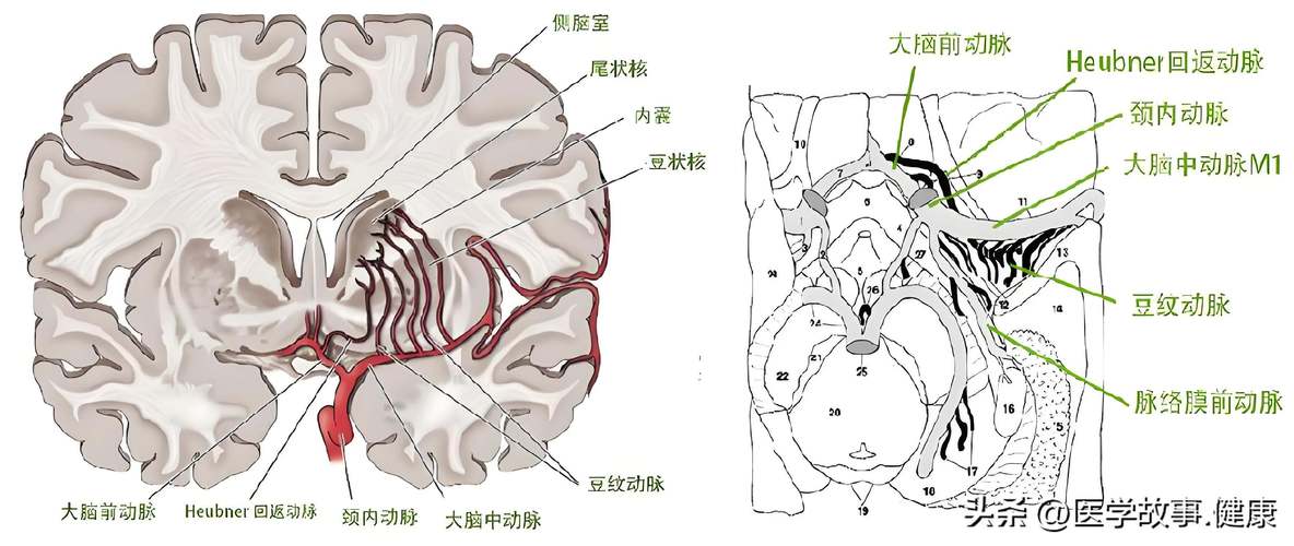 双侧基底节区腔梗灶是脑梗吗