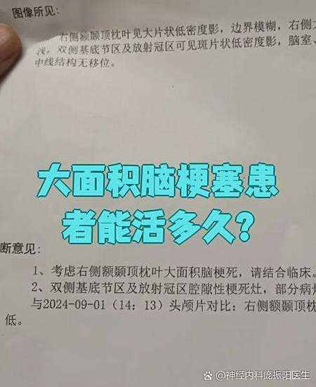 得了脑梗的人还能活多长时间