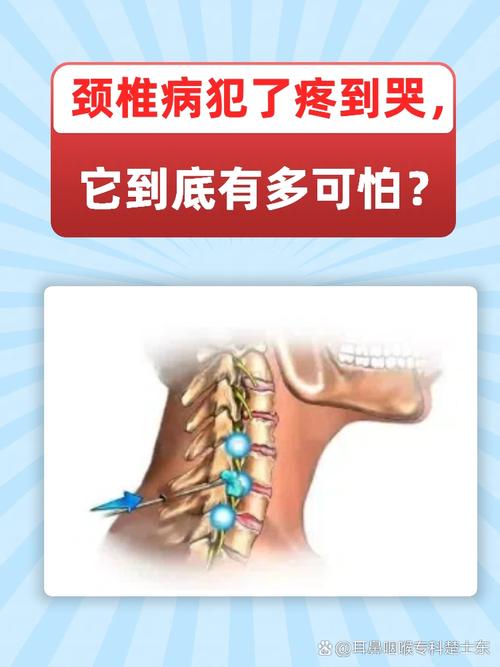颈椎可以导致脑梗和心梗嘛