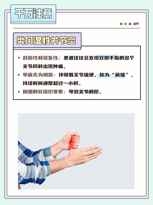 风湿抗o高手关节疼是风湿吗