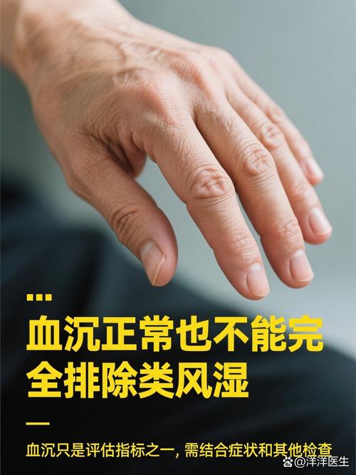 血沉高70是风湿还是类风湿