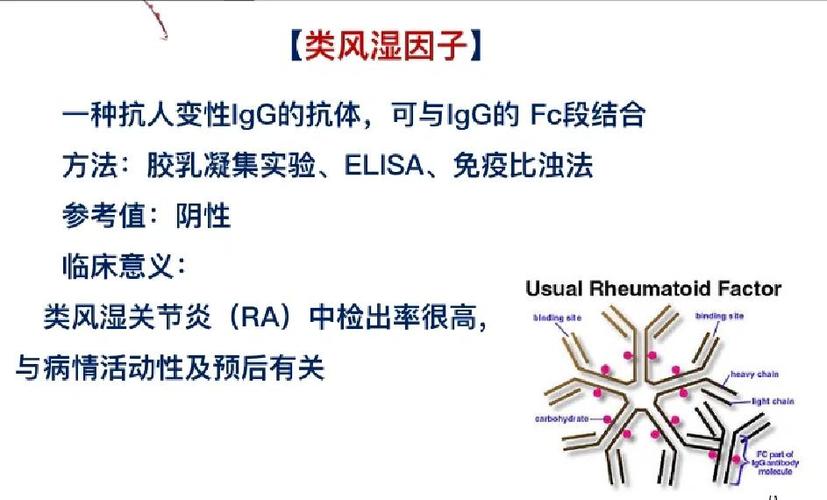 类风湿因子igm高是风湿吗