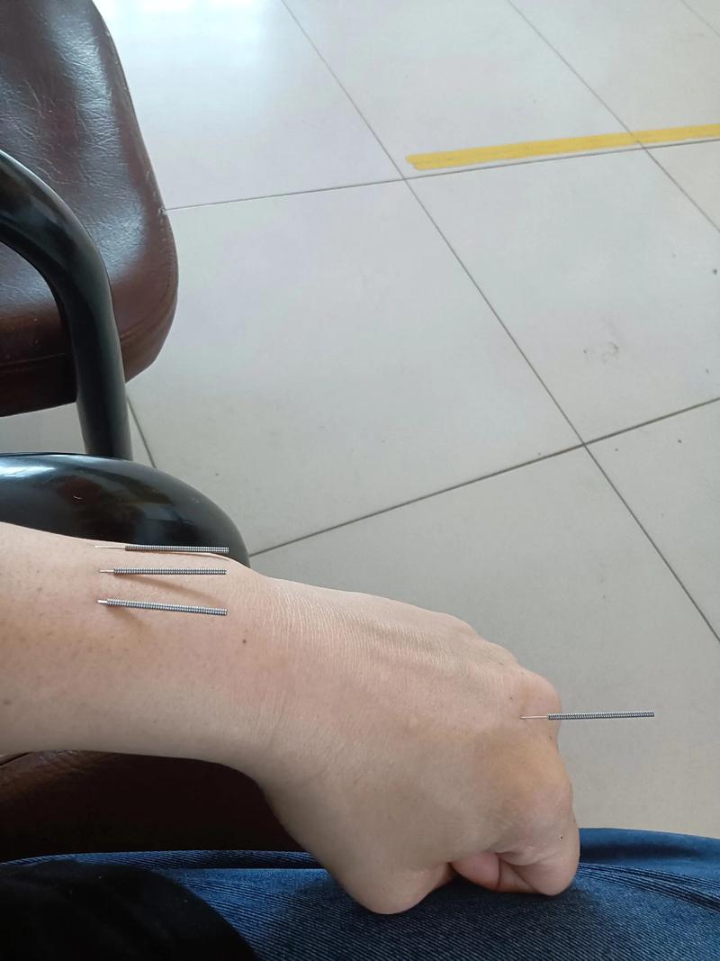 脑梗后遗症腿僵硬恢复方法