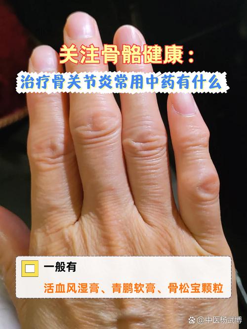 co风湿骨痛宁胶囊是假药吗