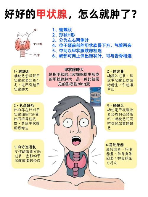 脑梗药物导致导致甲状腺