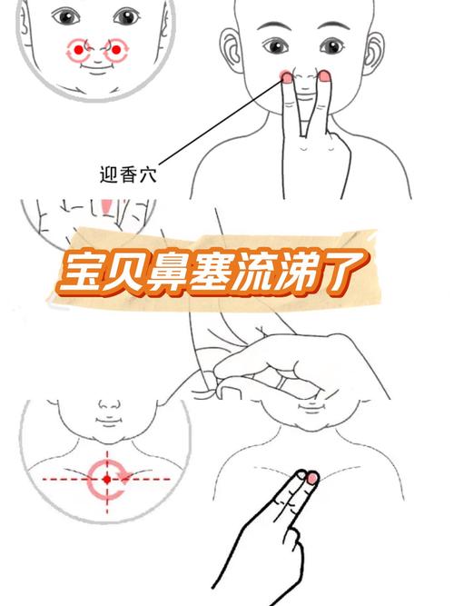 按摩穴位 止鼻血