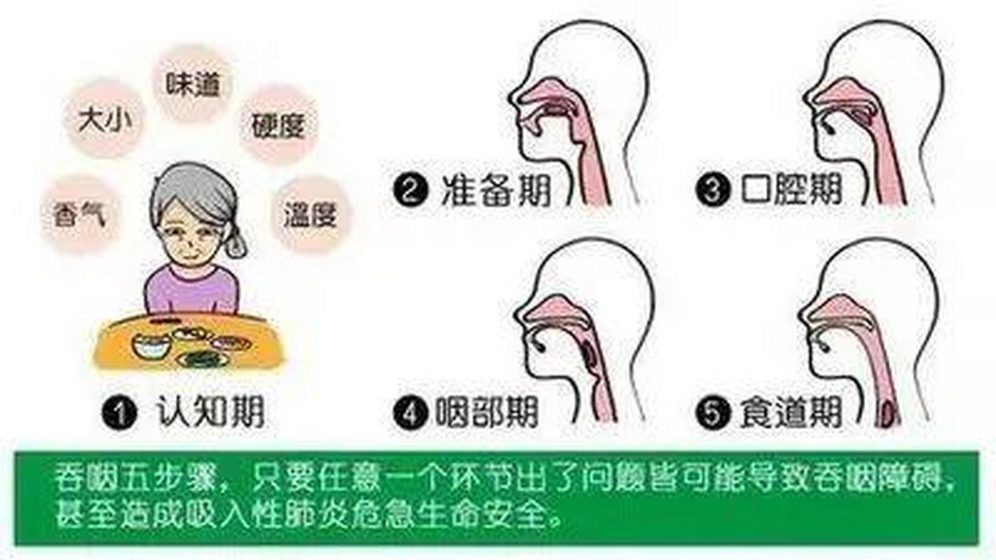脑梗 吞咽功能哪个部位
