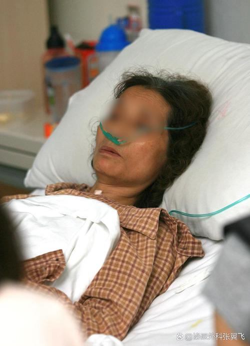 脑梗 癌症卧床病人呕吐