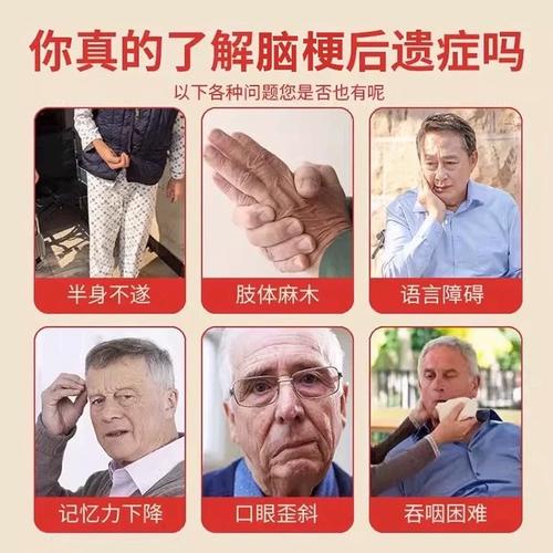 脑梗阿司匹林吃了嘴巴破