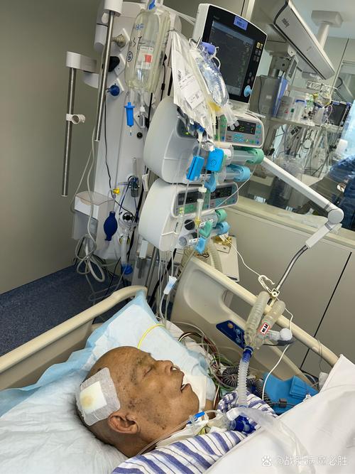 脑梗半个脑子坏死ICU