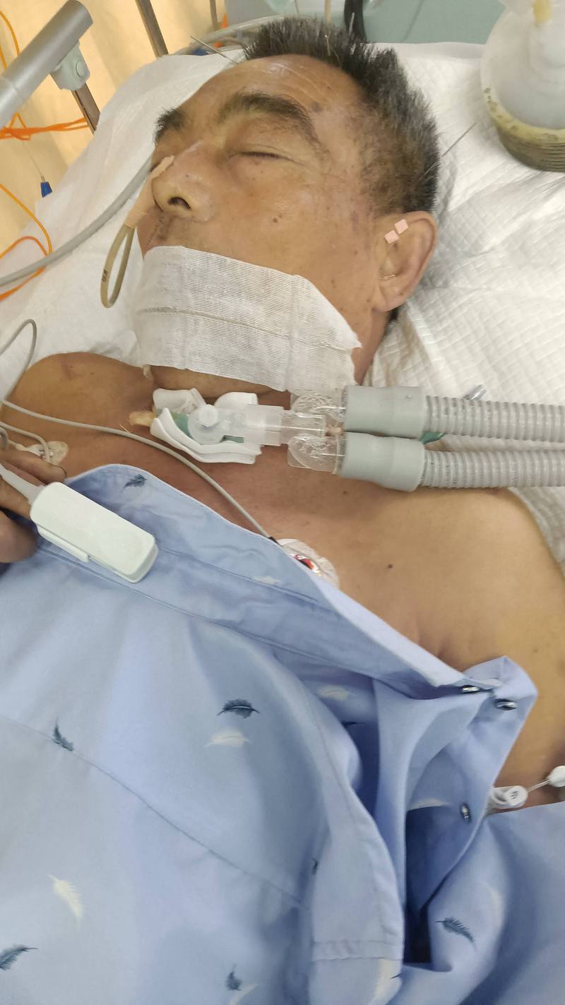 脑梗半个脑子坏死ICU