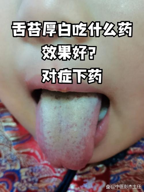 脑梗不能吞咽 舌苔发白