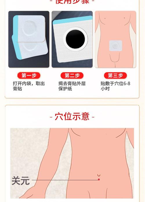 疝气穴位贴有哪几个穴位