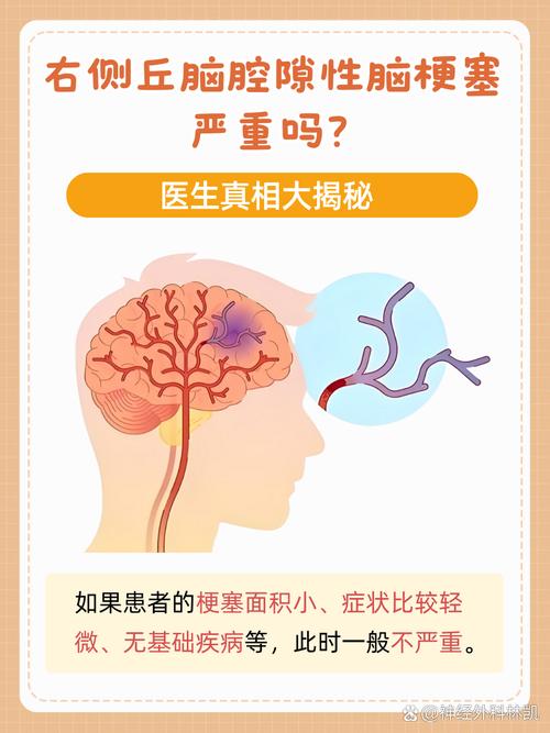 脑梗和脑腔梗是一回事吗