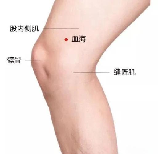 血海穴的准确穴位图穴位