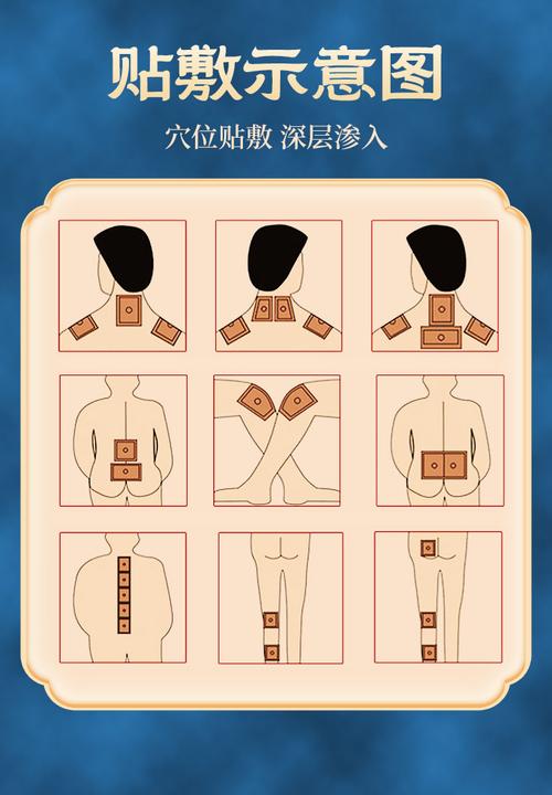 体痛穴位贴 穴位贴敷贴