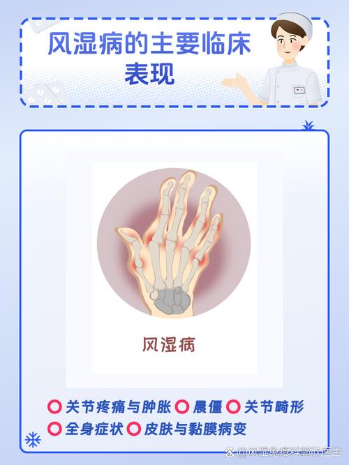 风湿和类风湿的症状是什么