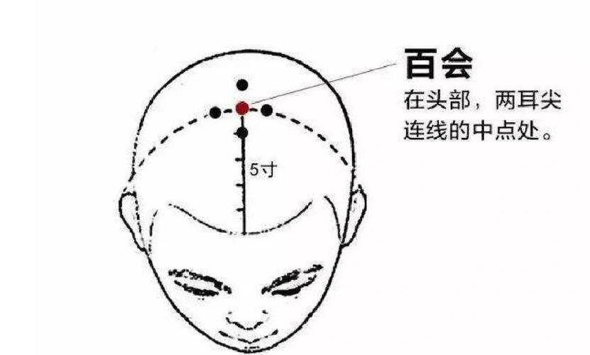 百会穴穴位的准确位置图