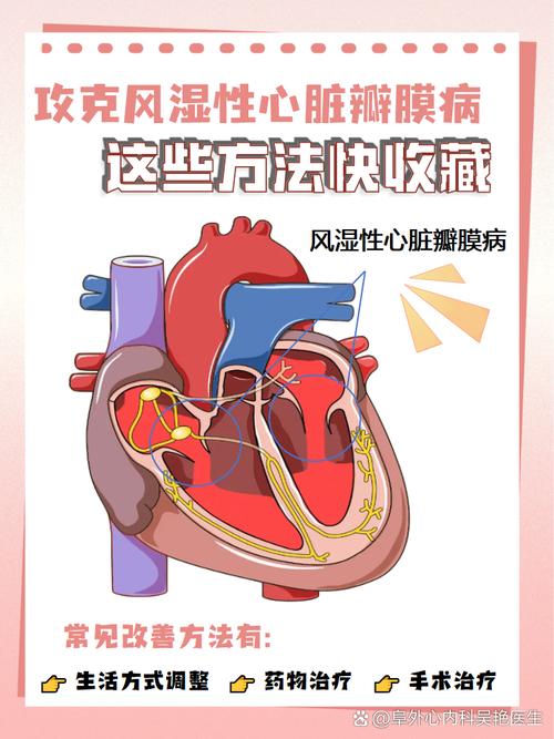 风湿性心脏病是类风湿吗