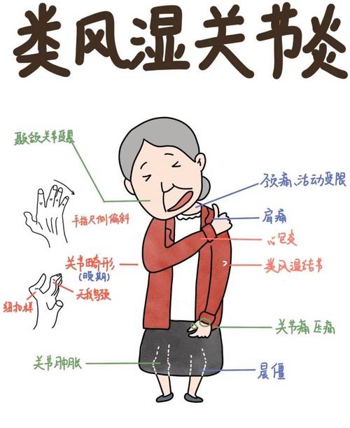 风湿就是风湿性关节炎吗