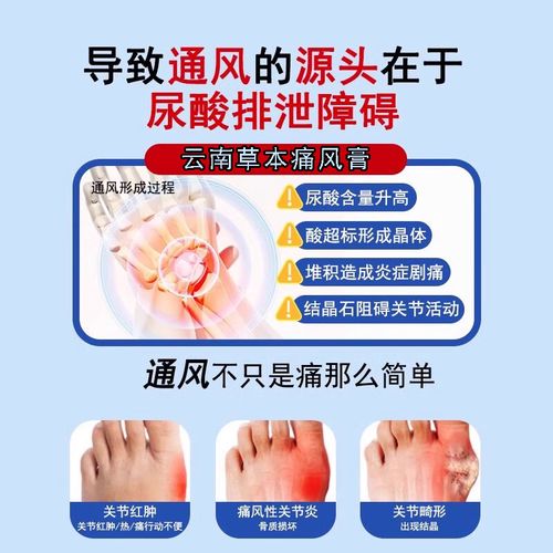 治类风湿类风湿病的地方