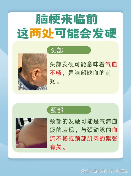 脑梗会引起脑供血不足吗