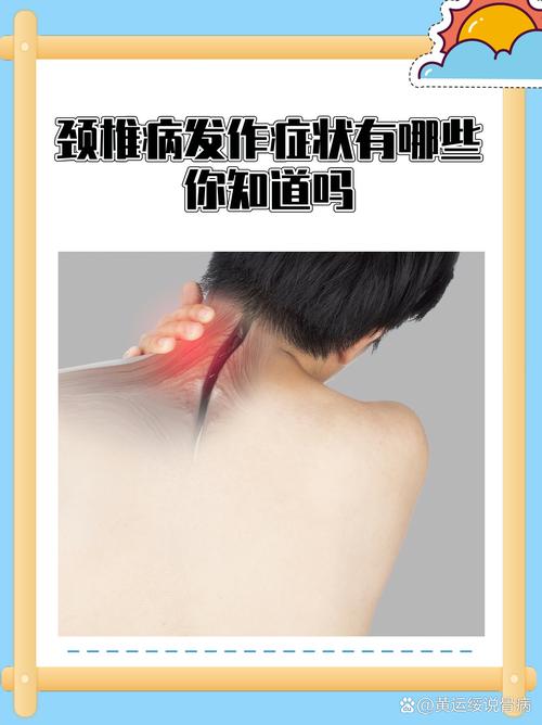 颈椎病风湿类风湿关节炎