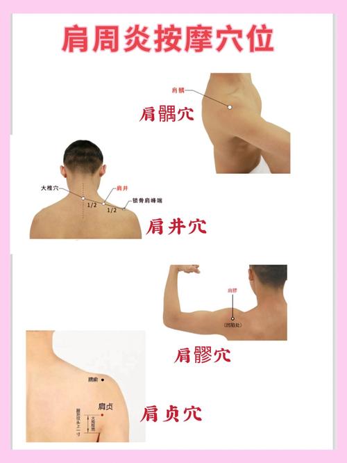 治疗肩关节周围炎的穴位