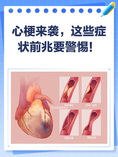 请问心梗脑梗有什么预兆