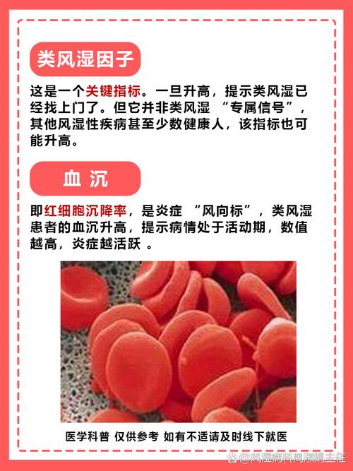 风湿三项就类风湿因子高