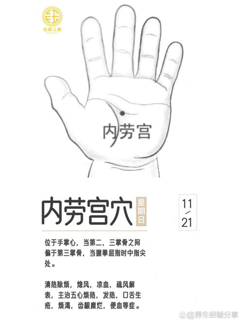 哪些穴位治疗失眠劳宫