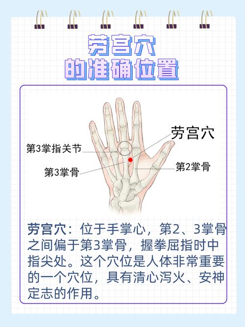 哪些穴位治疗失眠劳宫