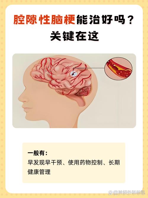 九玖活心脑真能治脑梗吗