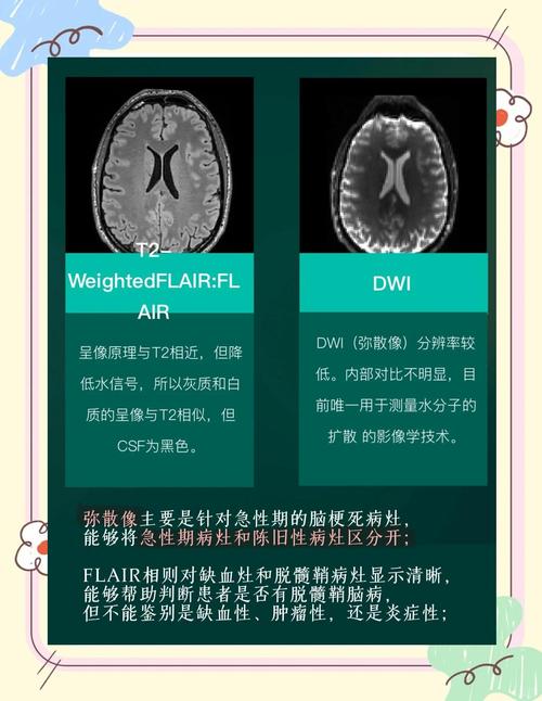做脑ct能检查出脑梗吗