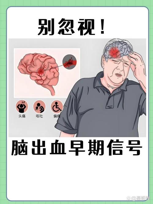 脑梗充血到脑花还有救吗