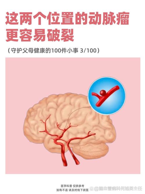 脑管瘤破裂和脑梗的区别