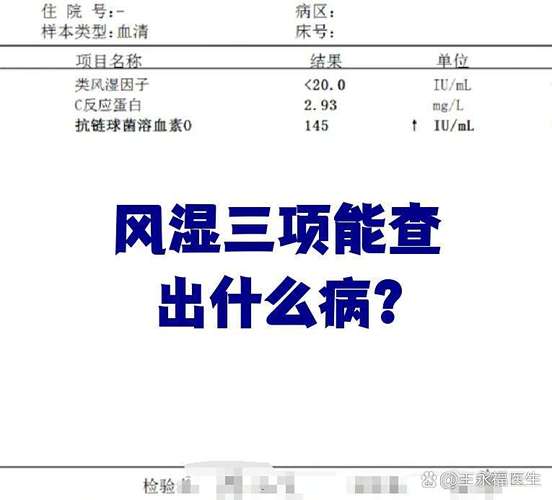 风湿和类风湿检查一样吗