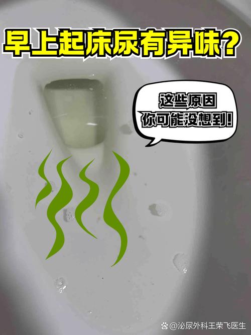 脑梗 心梗病人小便有味