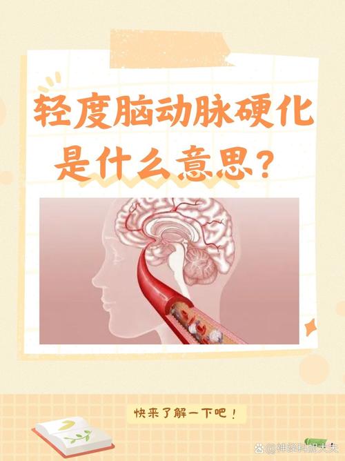 脑梗脑动脉硬化做啥检查