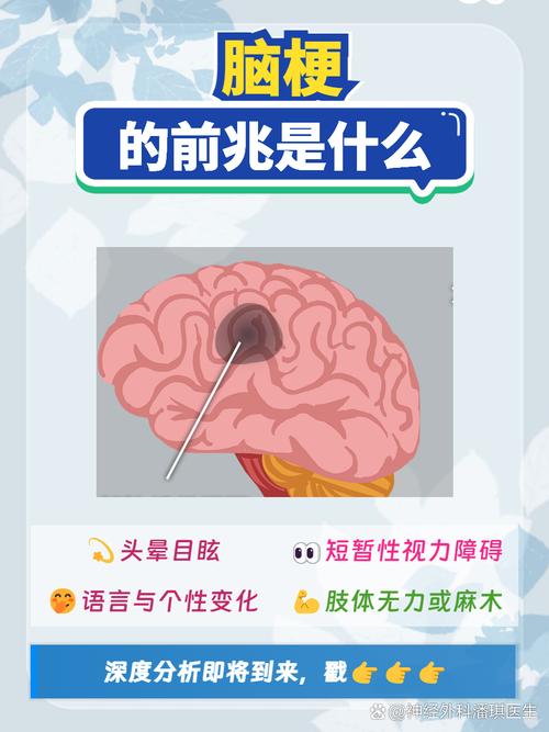 脑白质病变是脑梗前兆吗