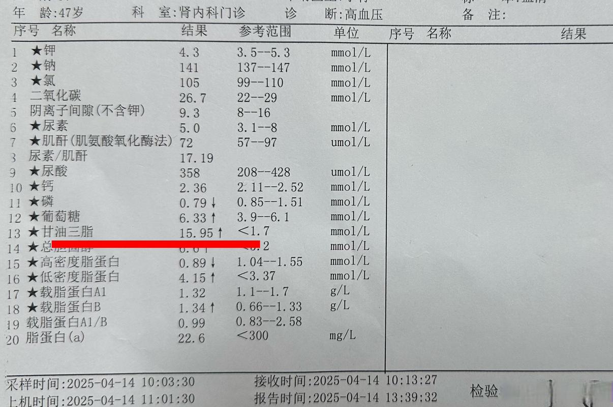 风湿类风湿抗o检查费用